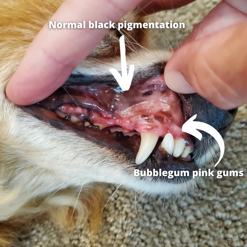 Healthy gums with pink and black normal pigment