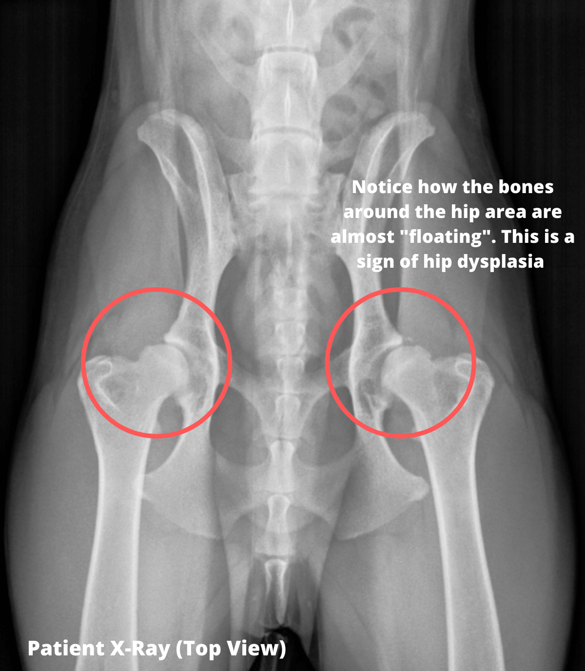 Patient X-ray