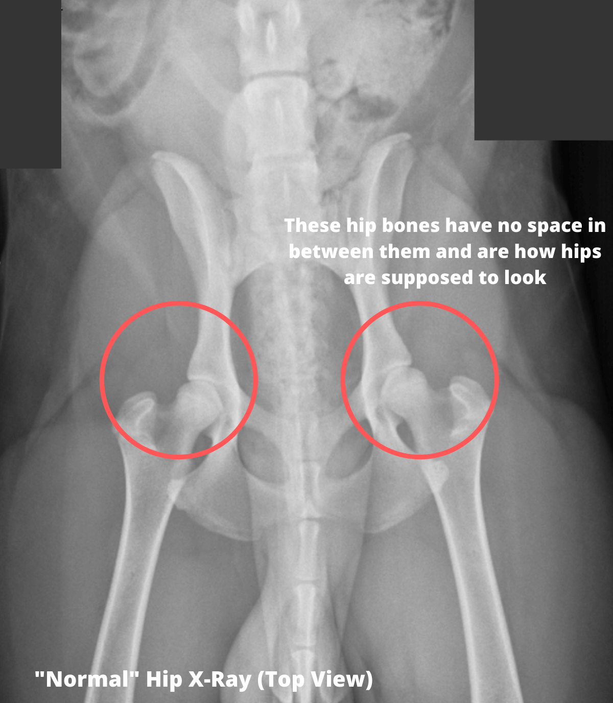 Normal Hip Xray