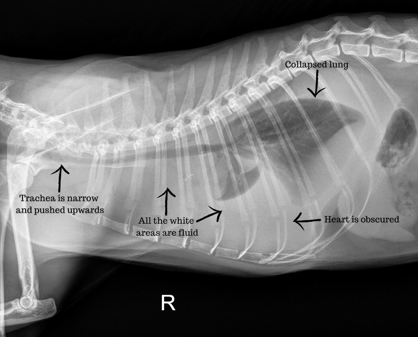 X-ray of Carlos' collapsed lung