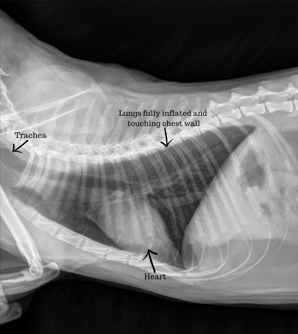 X-ray image of what a normal lung should look like (no white)